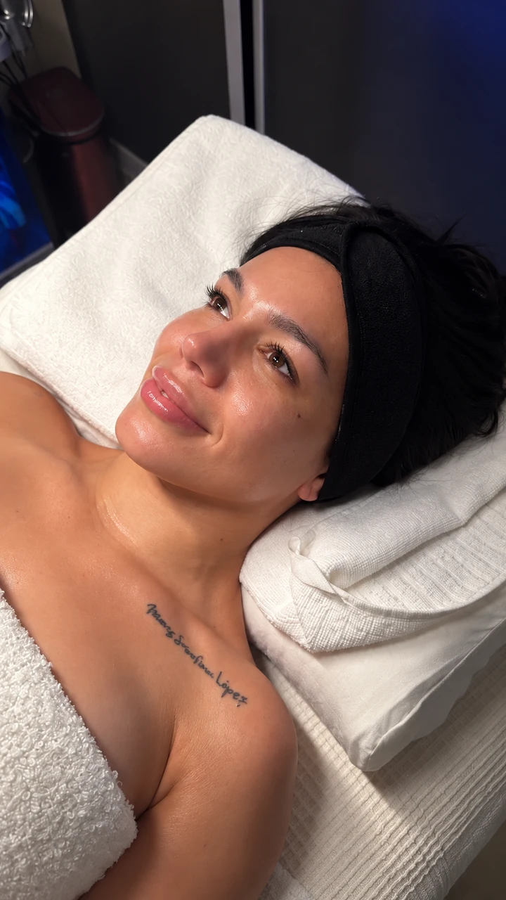 Fotografía 04 compartida como después de una sesión de Hydrafacial
